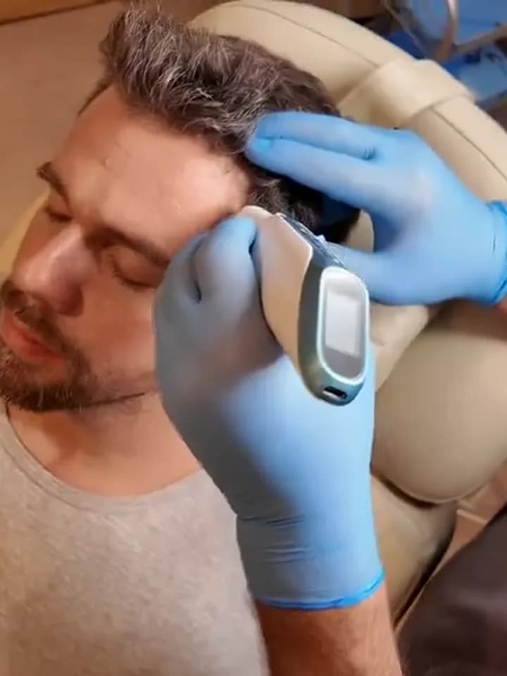 A scalp treatment being carried out at the Carisma Hair Clinic
